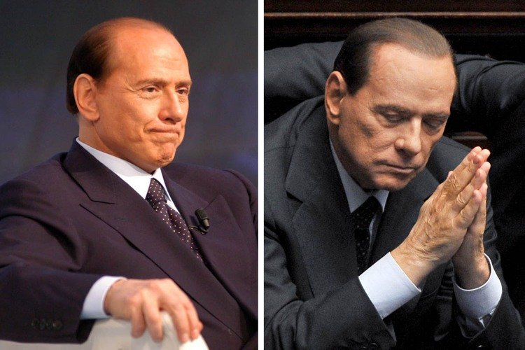 Przeszczep włosów-przed-po-doświadczeniach berlusconiego