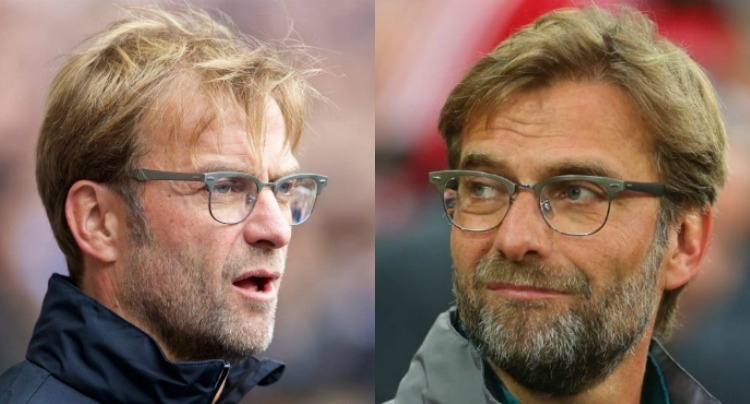 Przeszczep włosów-przed-po-obrazie-klopp-broda